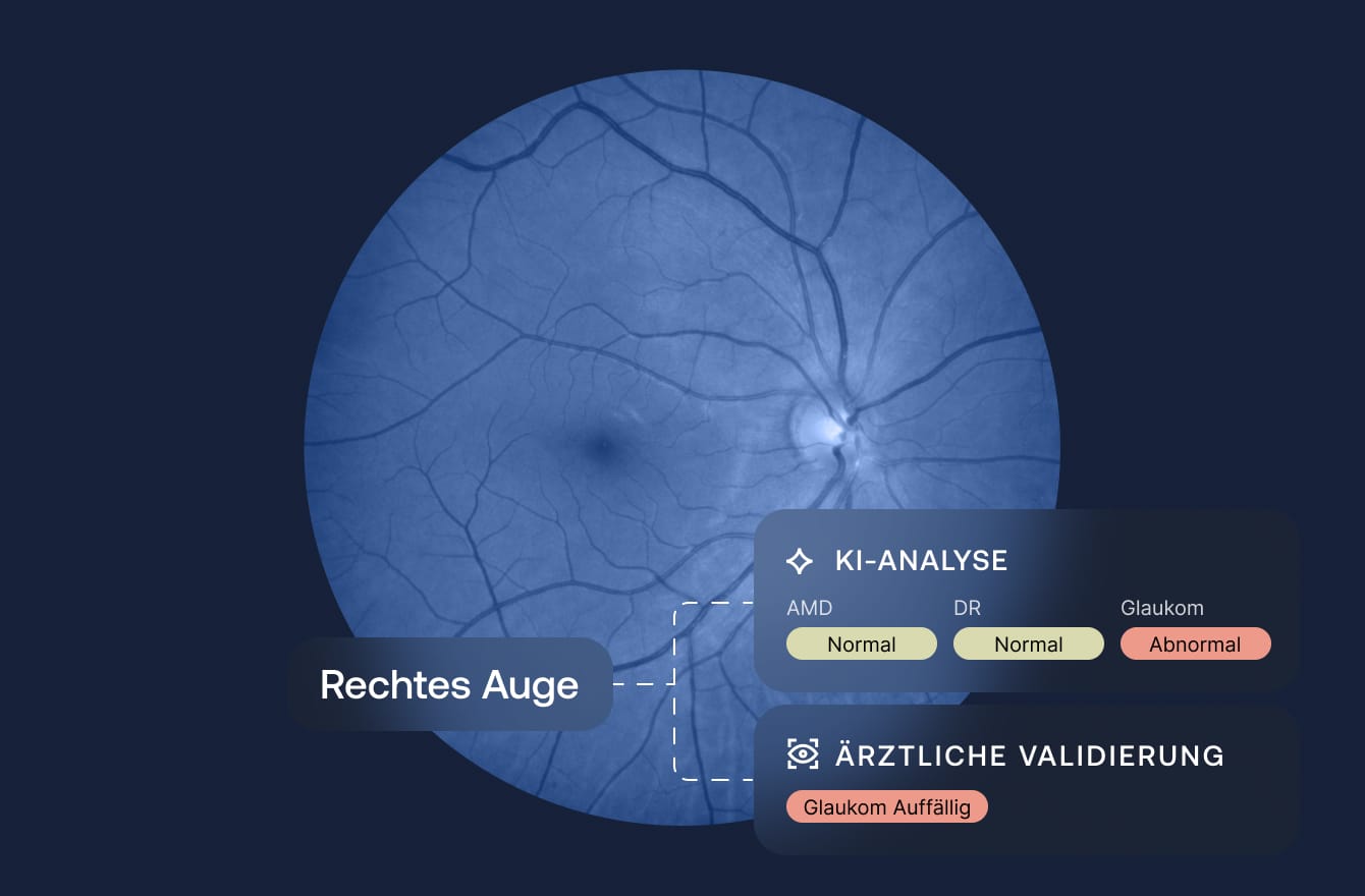 img-skleo-process-de